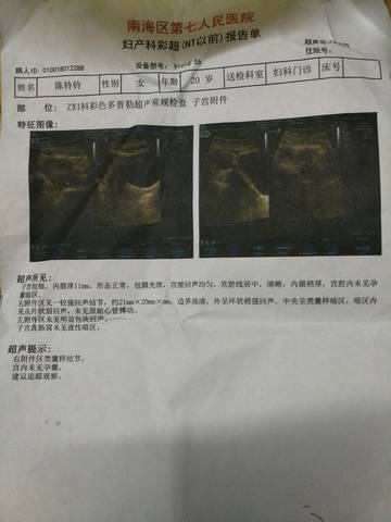 journal_insert_pic_732794538