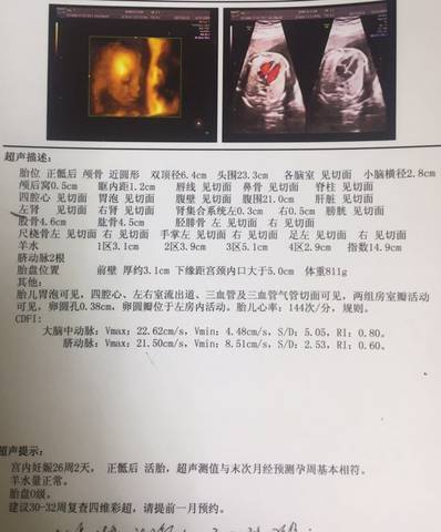 journal_insert_pic_734183912