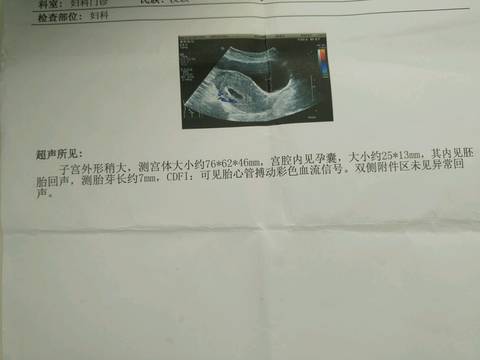 journal_insert_pic_734538907