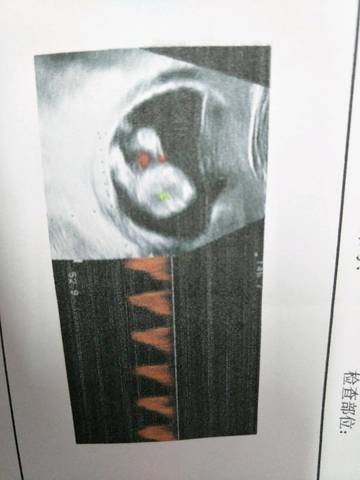 journal_insert_pic_735159170