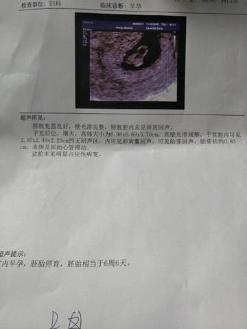 journal_insert_pic_737165122