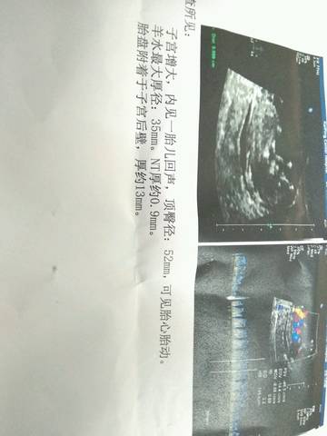 journal_insert_pic_737701094