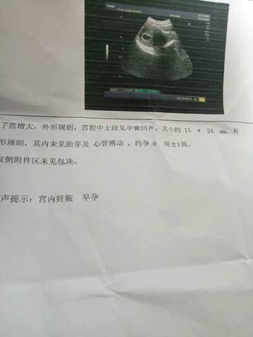 journal_insert_pic_738611447