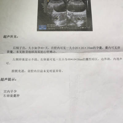 journal_insert_pic_739993731