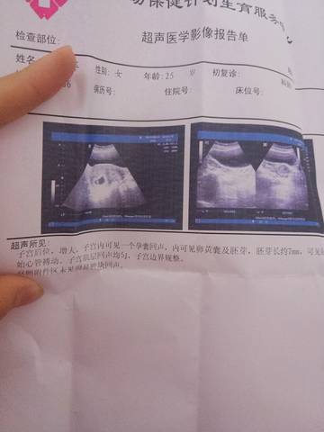 journal_insert_pic_743312465