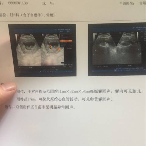 journal_insert_pic_743845019