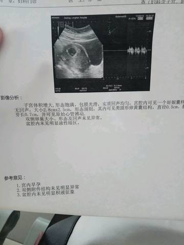 journal_insert_pic_745330952