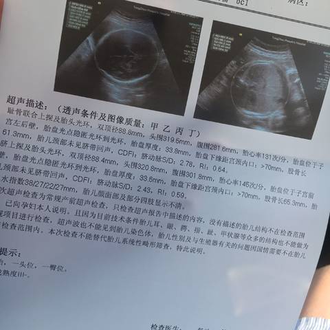 journal_insert_pic_745712089