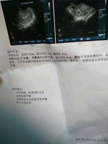 journal_insert_pic_747005640