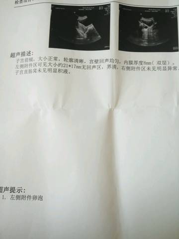 journal_insert_pic_747794054