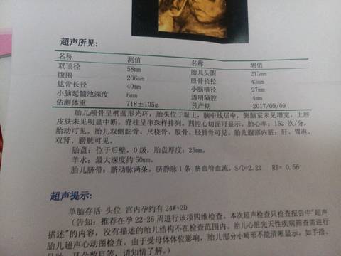 journal_insert_pic_748272257