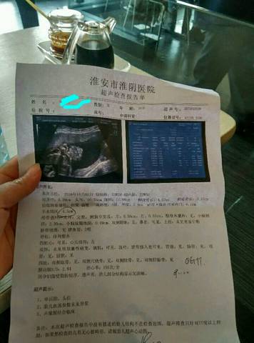 journal_insert_pic_748370610