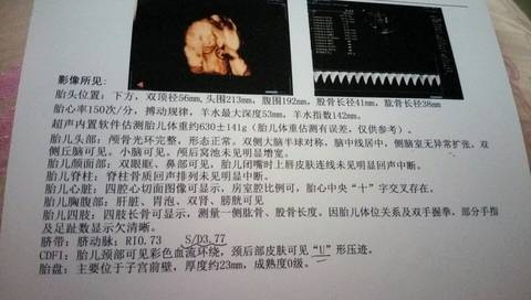 journal_insert_pic_748536292