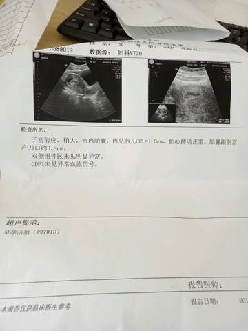 journal_insert_pic_749645116