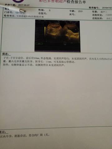 journal_insert_pic_752427270
