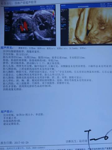 journal_insert_pic_757999634