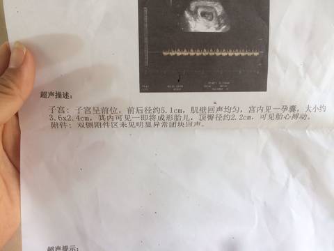 journal_insert_pic_757704133