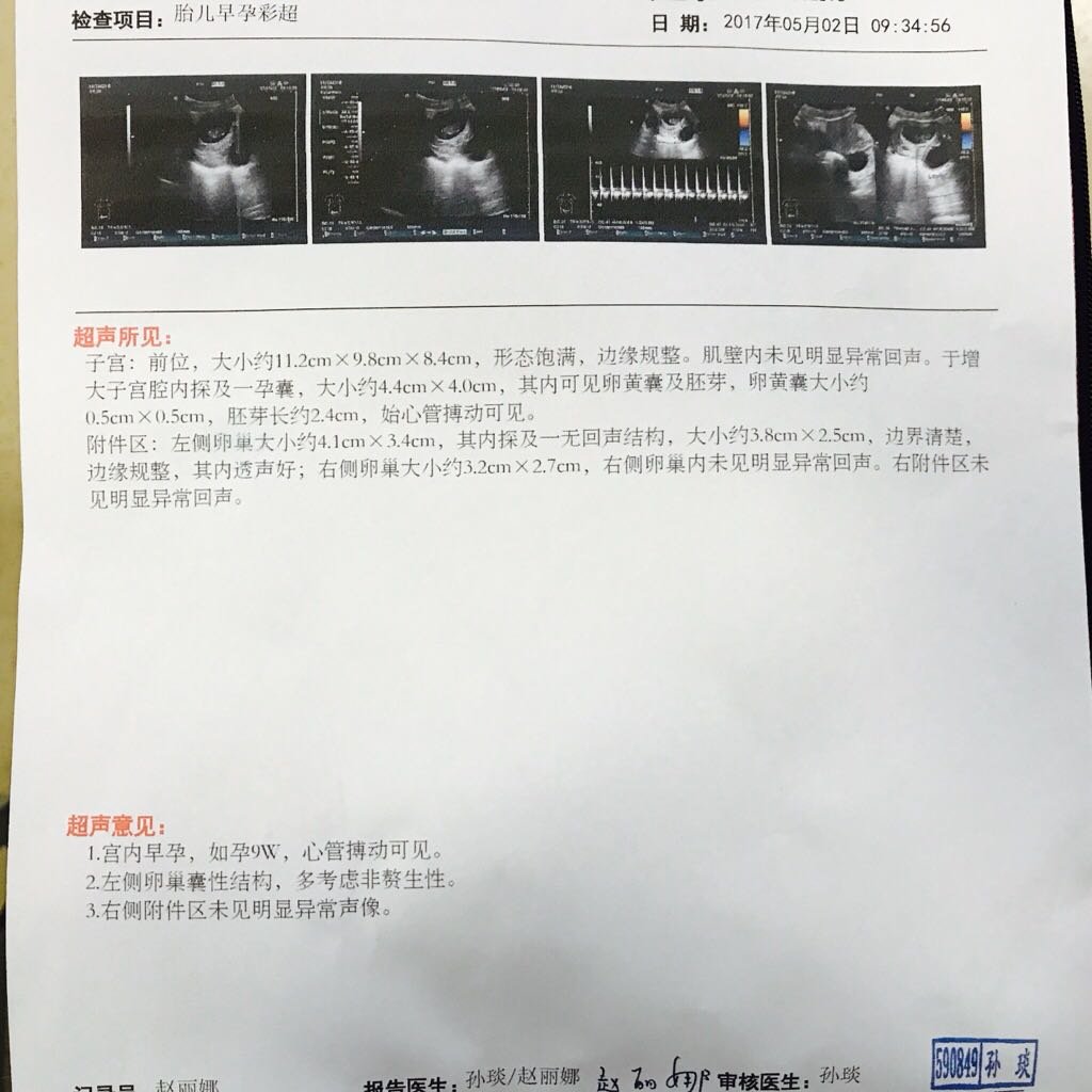 记录记录我的孕早期～愿大家都好孕