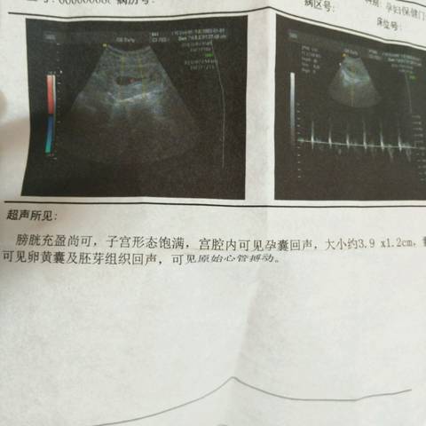 journal_insert_pic_759515284