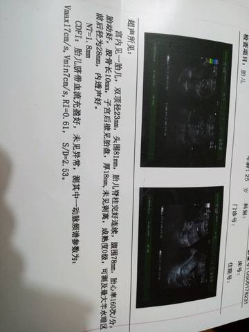 journal_insert_pic_760849836