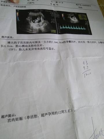 journal_insert_pic_761438430