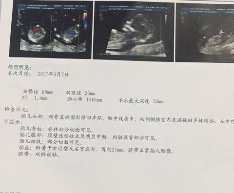 journal_insert_pic_762270267