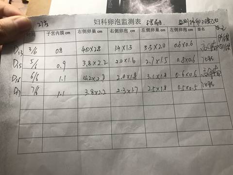 journal_insert_pic_762630731