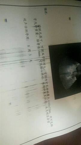 journal_insert_pic_763118373