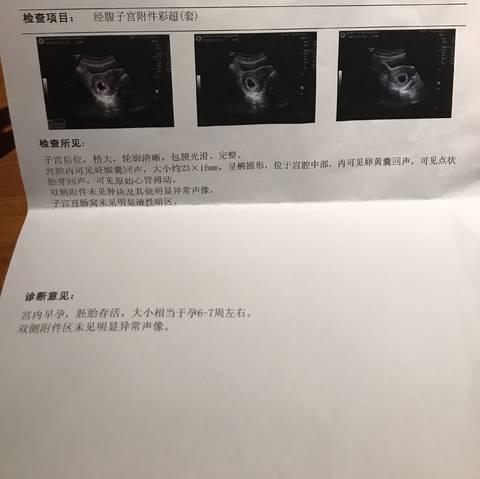 journal_insert_pic_764720359