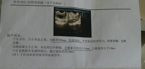 journal_insert_pic_766473508