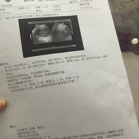 journal_insert_pic_766693864
