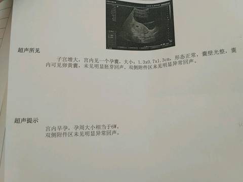 journal_insert_pic_767227901