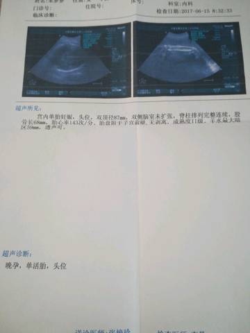 journal_insert_pic_768769582