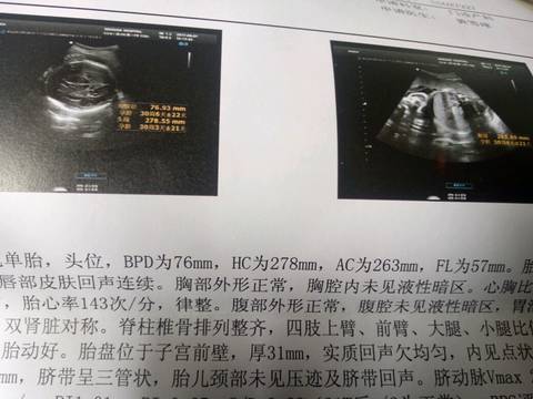 journal_insert_pic_770476603