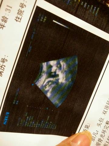 journal_insert_pic_770855573