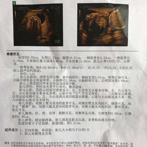 journal_insert_pic_771087290