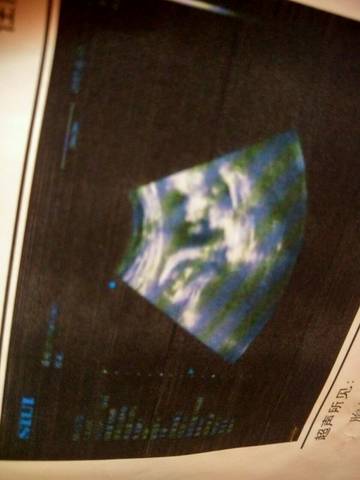journal_insert_pic_770855572