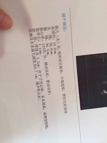 journal_insert_pic_771804596