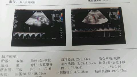 journal_insert_pic_771932028