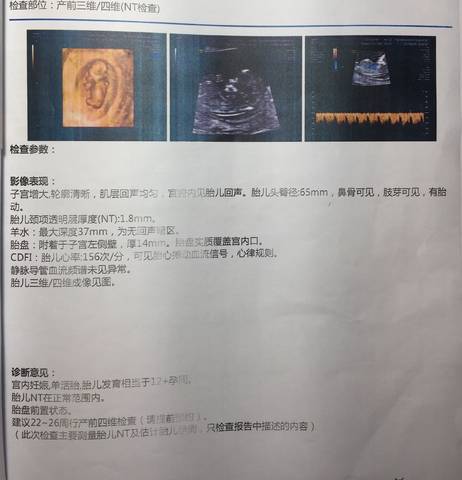 journal_insert_pic_774300314
