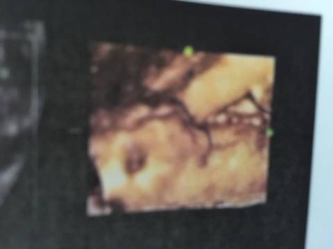 journal_insert_pic_774561910