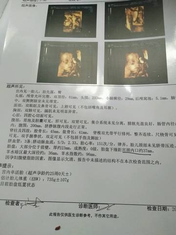 journal_insert_pic_774949409