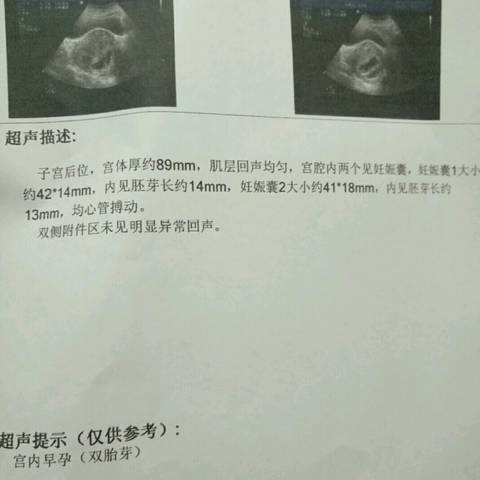 journal_insert_pic_776203143