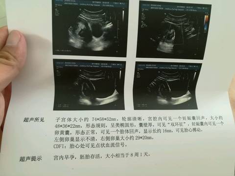 journal_insert_pic_776060116