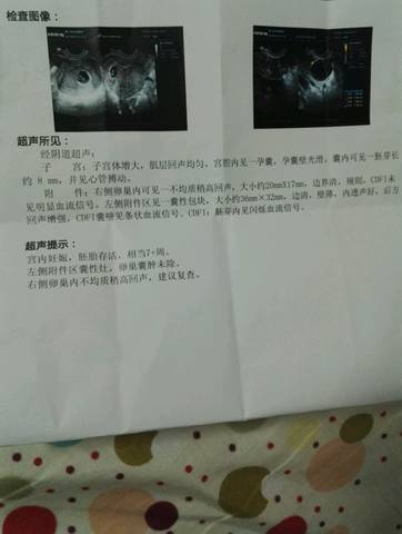 journal_insert_pic_776077468