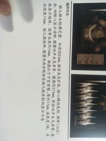 journal_insert_pic_775990554