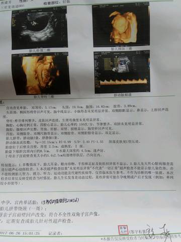 journal_insert_pic_777778100