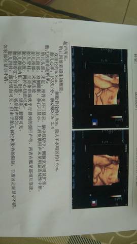 journal_insert_pic_779347952