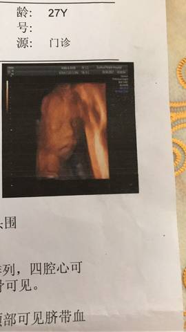 journal_insert_pic_779322600