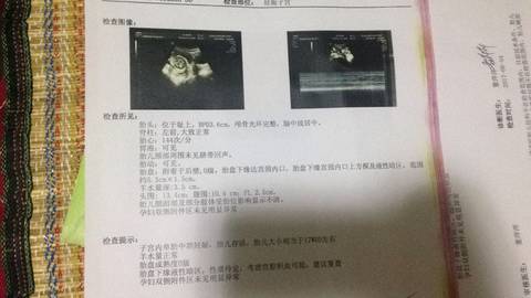 journal_insert_pic_779517714